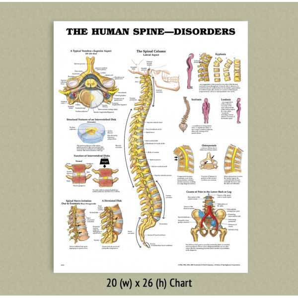 Anatomical Chart - Human Spine Disorders (LAMINATED ONLY)