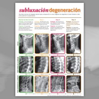 Handout - SPANISH Spinal Degeneration