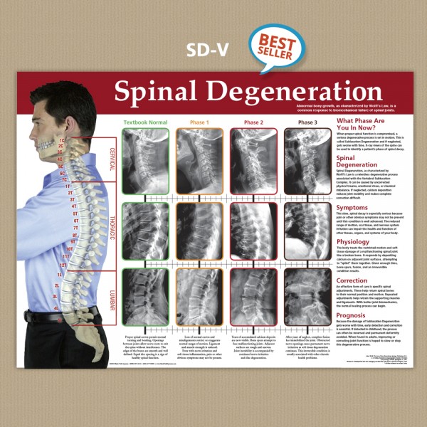 Poster - Spinal Degeneration